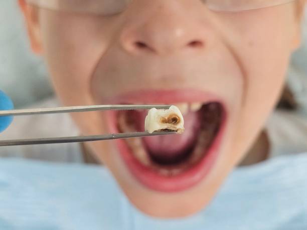 Best Weekend Emergency Dentist in Pine Grove, CA